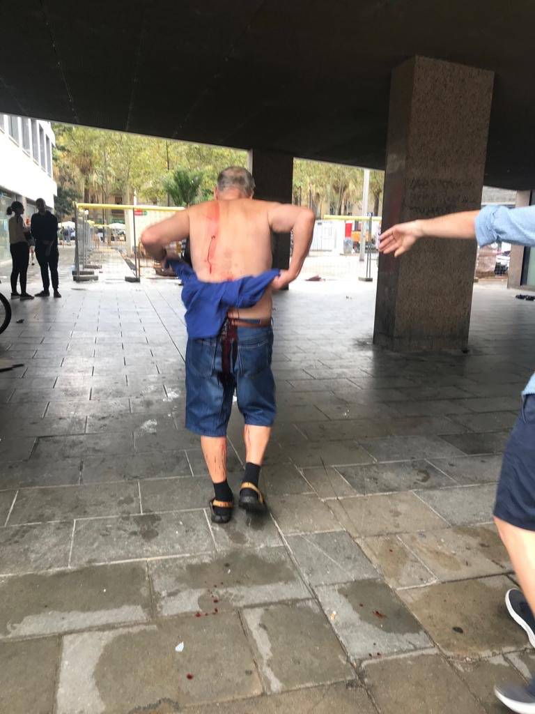 Apuñalado en el Raval de Barcelona por recriminar a un individuo que orinaba en la calle