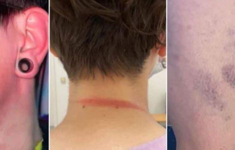 La famille du jeune homme victime d'une agression à la Belgian Pride réagit: "Ce fut un moment très violent qui nous a profondément marqués"