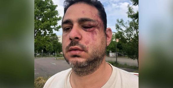 Strasbourg : Le mari d'une candidate LR aux législatives roué de coups en pleine rue