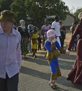 Tanzanie: des associations dénoncent la « recrudescence » des attaques contre les albinos