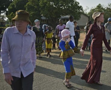 Tanzanie: des associations dénoncent la « recrudescence » des attaques contre les albinos