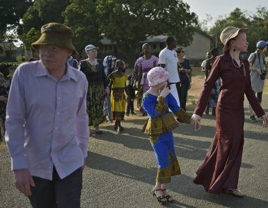 Tanzanie: des associations dénoncent la « recrudescence » des attaques contre les albinos