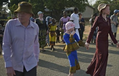 Tanzanie: des associations dénoncent la « recrudescence » des attaques contre les albinos