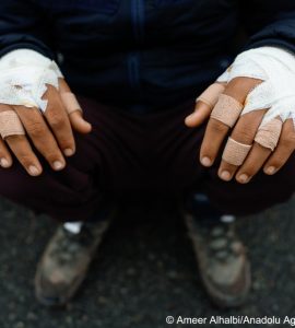 Près de Calais, une rixe implique une centaine de migrants