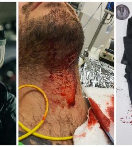 Un trafiquant de drogue, qui a tiré sur un policier, obtient son acquittement pour tentative de meurtre : « Il n’est pas exclu qu’il ait agi en état de légitime défense »