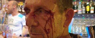 Témoignage "Je vais te planter sale pédale" : trois personnes victimes d'une violente agression devant un bar gay
