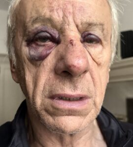 Jean-Christophe Rufin blessé après son agression à Bourges