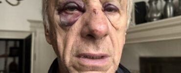 Jean-Christophe Rufin blessé après son agression à Bourges