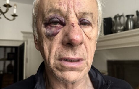Jean-Christophe Rufin blessé après son agression à Bourges