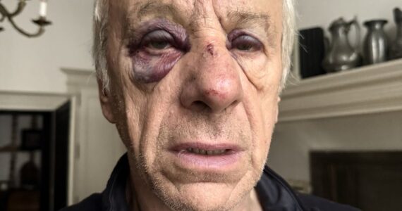 Jean-Christophe Rufin blessé après son agression à Bourges