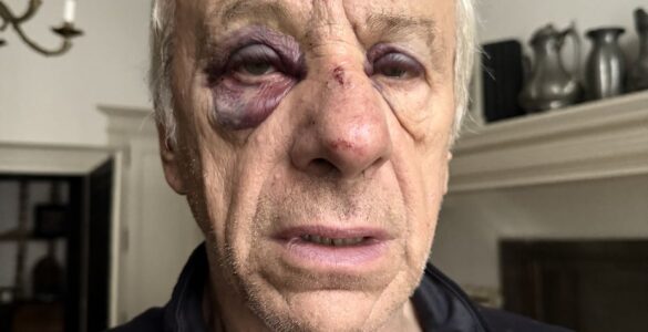 Jean-Christophe Rufin blessé après son agression à Bourges